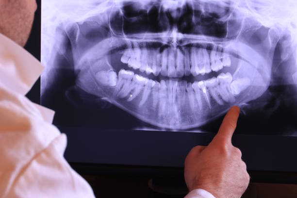 Best Weekend Emergency Dental Services in San Luis Obispo, CA