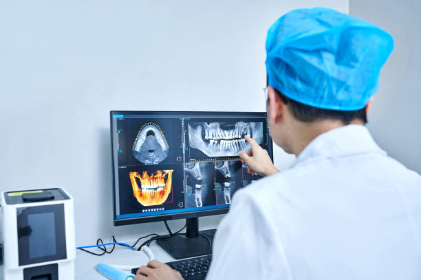 Best Emergency Care for Gum Disease in San Luis Obispo, CA